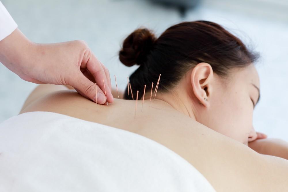 PALOS VERDES ACUPUNCTURE